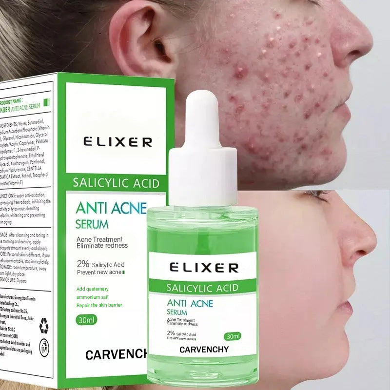 Anti-acne Soothing And Hydrating Skin Lotion